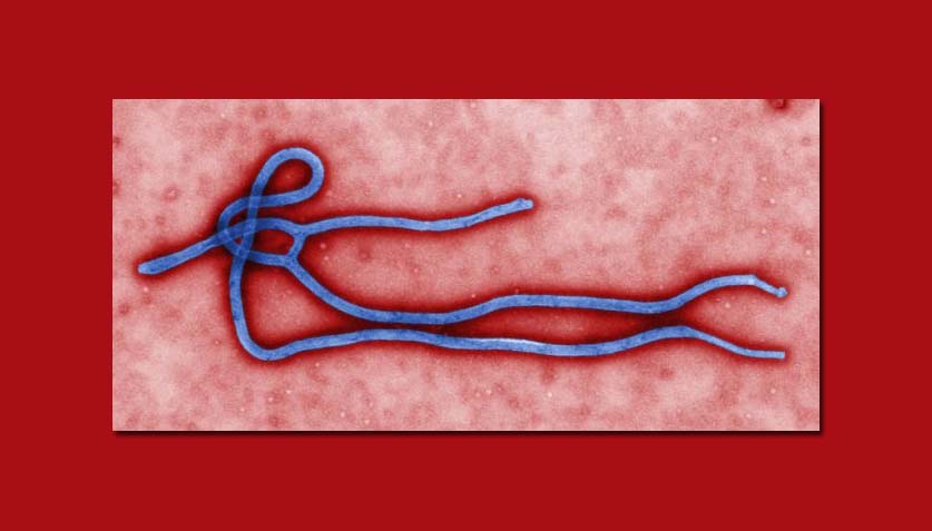 CDC, 에볼라 발병국에 대한 여행제한 발표