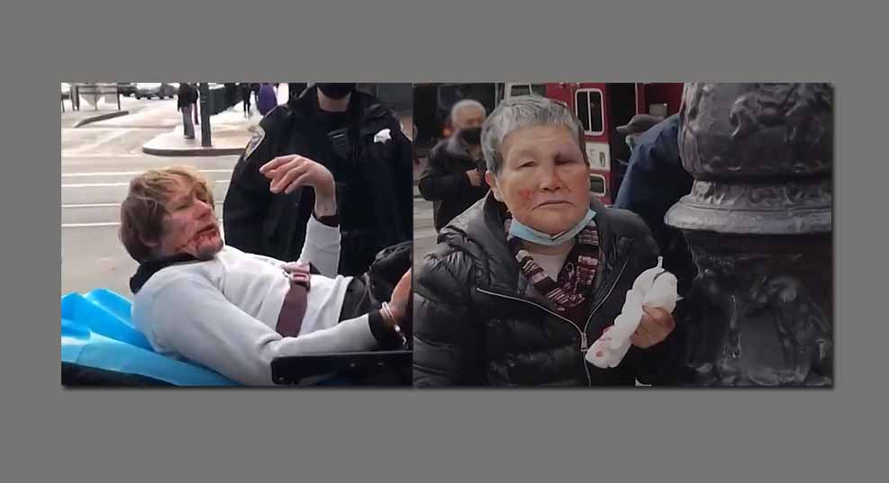 샌프란시스코에서 75세의 한 아시아 여성 공격 받은 후 반격