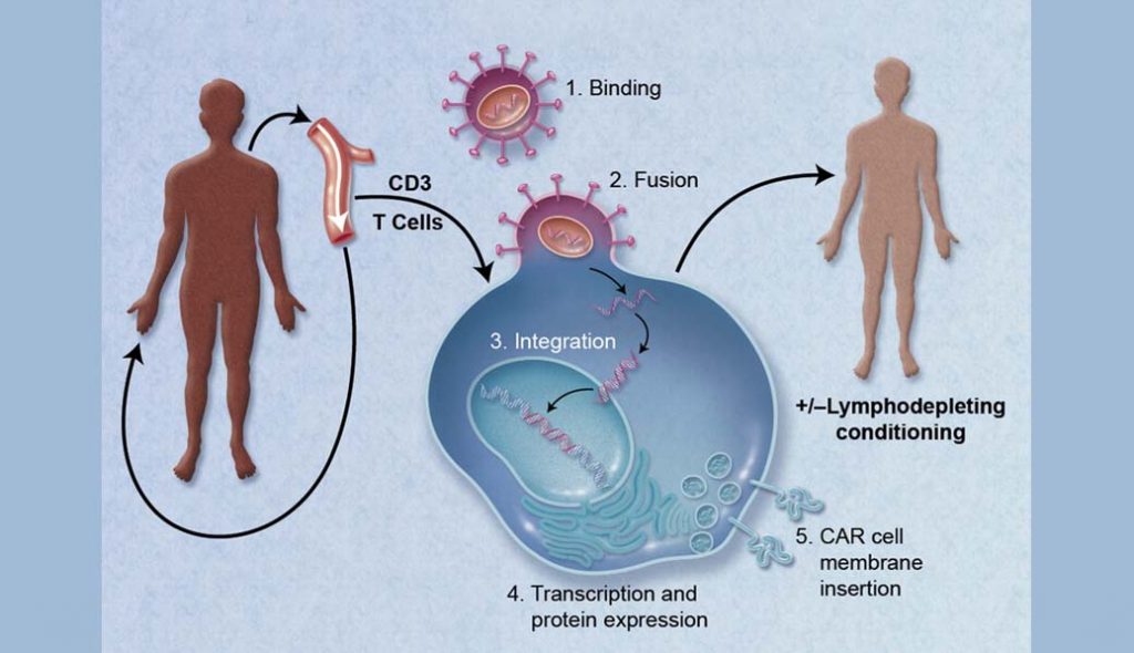 2명의 백혈병 환자, T-세포 면역치료요법 가능성 발견