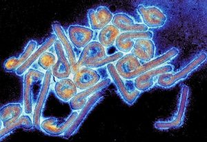 CDC, 아프리카 국가들에서 퍼지는 마르부르크 바이러스 경고
