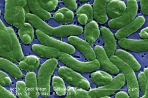 코네티컷과 뉴욕, 피부 조직먹는 희귀한 박테리아 감염돼 3명 사망